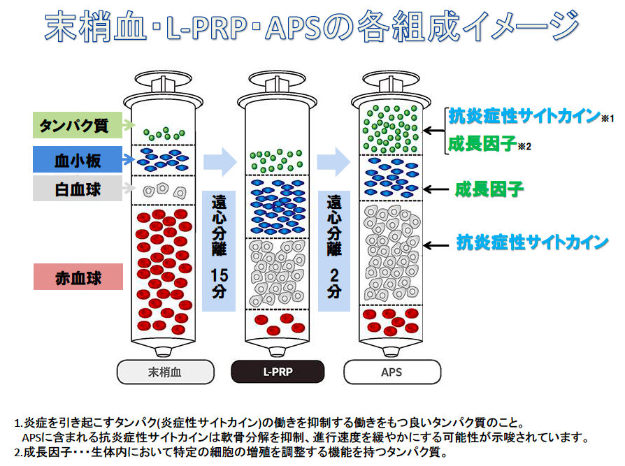 PRP分離過程の説明